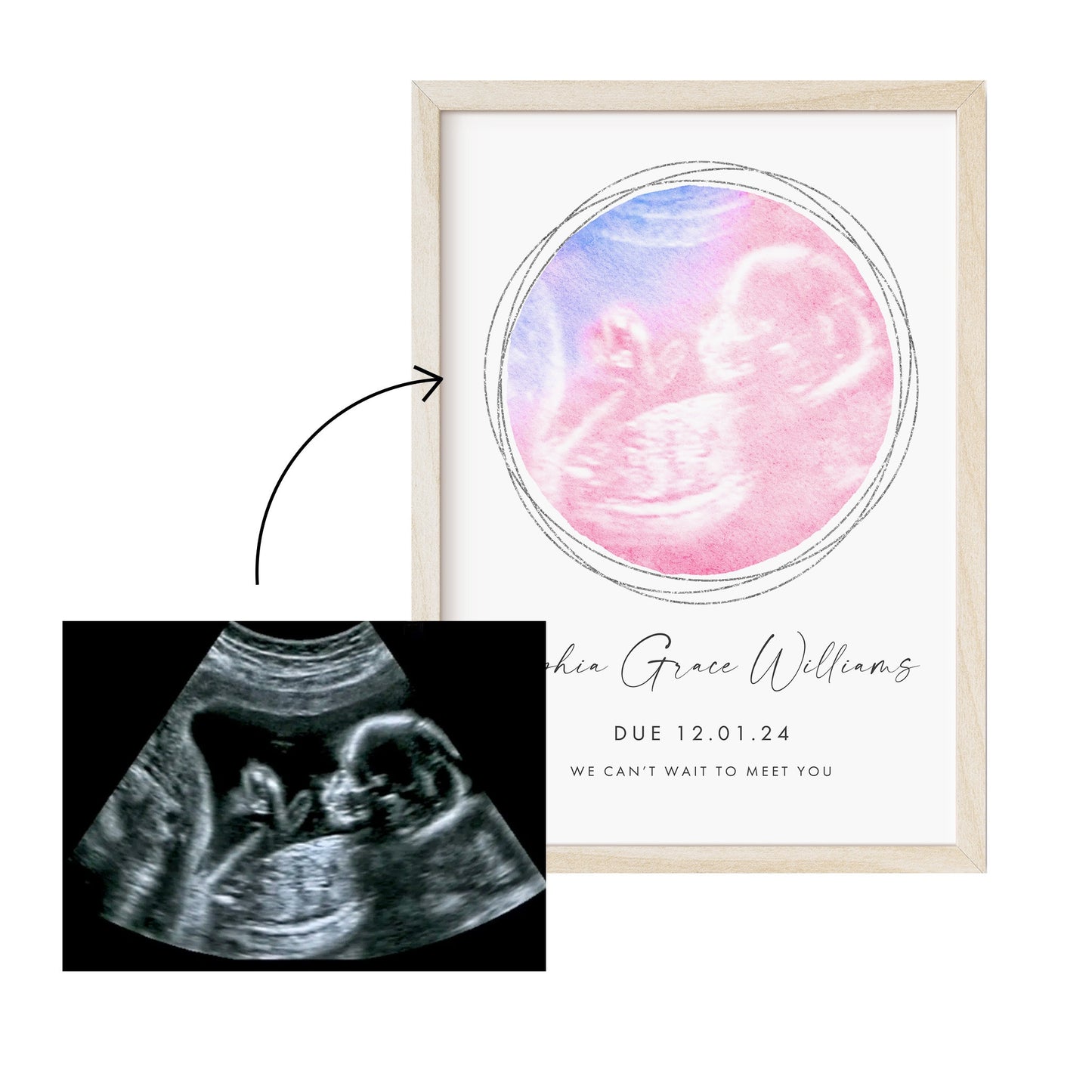 Watercolour Baby Scan Print, Congratulations Pregnancy Gift