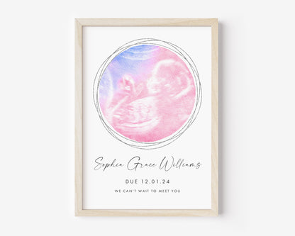 Miscarriage Memorial Gifts, Personalised Pregnancy Scan Print